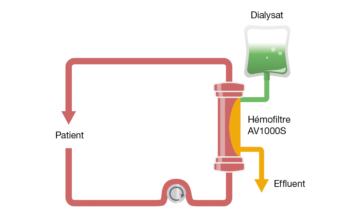 Configuraciones de la CRRT | Fresenius Medical Care