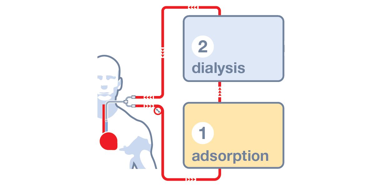 Adsorption und Dialyse in einem einzigen Gerät