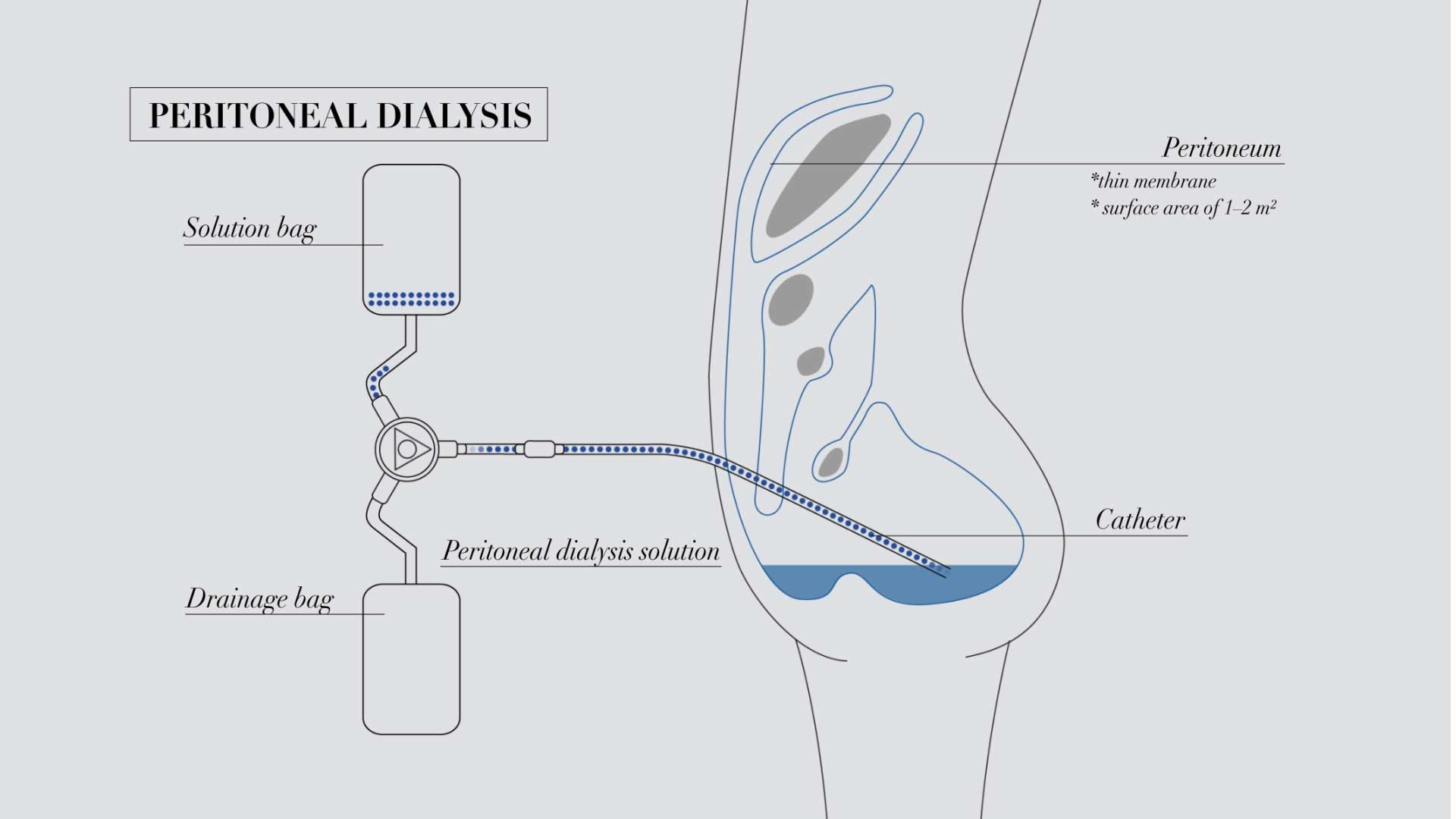 Peritoneal Dialysis Membrane